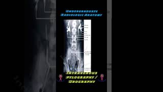 Undergraduate Basic Radiologic Anatomy  Intravenous Pyelography  KUB Xray anatomy [upl. by Nedle]