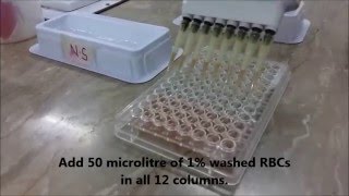 AJs Science 2 How to perform Hemagglutination assay HA Test [upl. by Gnort748]