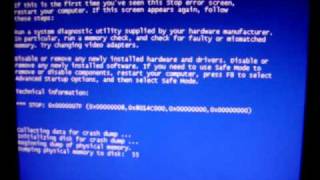 Windows Vista Instant BSOD 7F When Unplugging Dazzle Capture Card [upl. by Mary316]