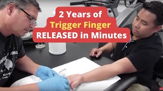 2 Years of  Trigger Finger  RELEASED in Minutes REAL RESULTS [upl. by Heather]