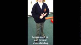 Megans amazing walking after selective dorsal rhizotomy [upl. by Egin]