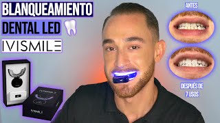 BLANQUEAMIENTO DENTAL CON LUZ LED [upl. by Healey]