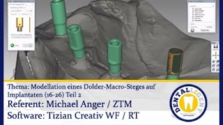 EXOCAD TUTORIAL Teaser  Modellation eines DolderMacroSteges auf Implantaten 1626 Teil 2 [upl. by Gnek]