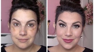 FULL COVERAGE Makeup for Melasma amp Discoloration [upl. by Eimaraj]