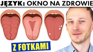 Wyczytaj choroby i niedobory z wyglądu swojego języka Zmiany na języku  Dr Bartek Kulczyński [upl. by Eissac]