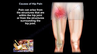 hip pain causes diagnosis and treatment [upl. by Carothers]