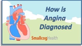 How is Angina Diagnosed [upl. by Mast]