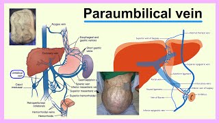 paraumbilical vein [upl. by Ediva]