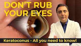 All you need to know about Keratoconus [upl. by Dowling]