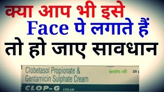 Clop G Cream Review Uses And Side Effects in Hindi  Rang Gora Krne Waali Cream Ka Sach [upl. by Ahsirek]