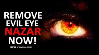 REMOVE EVIL EYE NOW  Very Powerful  MUST WATCH [upl. by Iot]