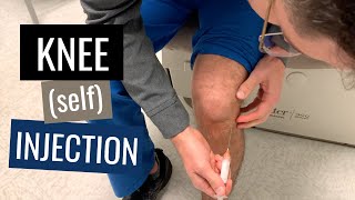 Knee Injection Steroid Technique Blind Anterolateral Approach [upl. by Erickson]