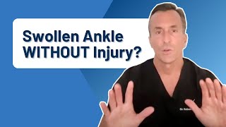 What Causes Ankle Pain and Swelling WITHOUT Injury [upl. by Niotna424]