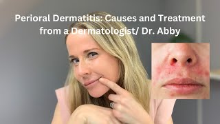 Perioral dermatitis causes and treatment from a Dermatologist [upl. by Suaeddaht]