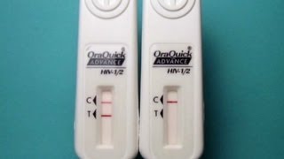 FDA has approved Home HIV Test Kit [upl. by Ailatan]