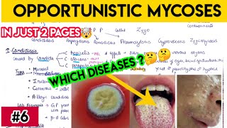 opportunistic mycoses  candidiasis aspergillosis zygomycosis in simplified way [upl. by Nylirac]