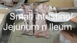 Anatomy of Small intestine jejunum ileum [upl. by Anitselec766]