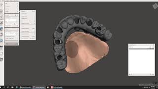 3D printed hybrid Meshmixer and Romexis [upl. by Eifos]