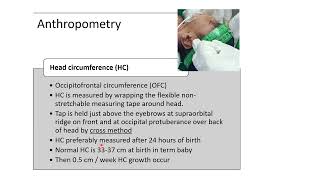 Anthropometry Measurements in Newborn  Pediatrics [upl. by Noffihc175]