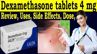 Dexamethasone tablets ip 4mg uses in hindi  review galen 4 mg tablets  Uses Side Effects Dose [upl. by Nylednarb]