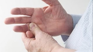 Psoriatic Arthritis  Treatment Options [upl. by Arias322]