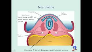 Newborn Neurological Disorders Part 2  CRASH Medical Review Series [upl. by Jillane]