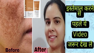 Dermatouch Bye Bye Pigmentation Cream Review Uses  Best Cream for Blemishes amp Dark Spots [upl. by Etnwahs]