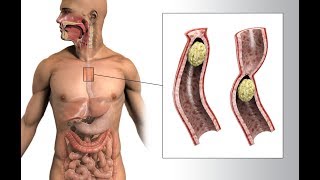 Mechanism Process Food in Mouth Esophagus and Stomach [upl. by Eelytsirk]