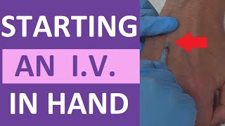 How to Start an IV  IV Catheter Insertion amp Flush Technique in Hand  Nursing Skill [upl. by Bart718]