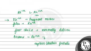 Explain the initiation of muscle contraction What is the role of sarcoplasmic reticulum myosin [upl. by Teerell368]