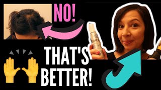 MORNING GRWM ROGAINE HAIR STYLING ROUTINE Putting on makeup and covering up thin and balding spots [upl. by Alithea276]