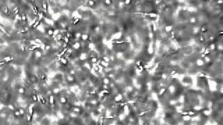 Semen sperm cells under the microscope at 400x [upl. by Aklam]