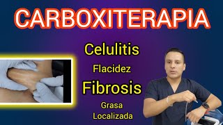 Carboxiterapia  Celulitis flacidez fibrosis Grasa Localizada  Aplicación [upl. by Alemaj709]