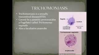 Parasitology Trichomoniasis Part 3 [upl. by Ecydnarb21]