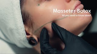 Masseter botox [upl. by Irac]