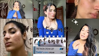 How to use tretinoin 0025 my journeyE2 tretinoin tretinoincream myjourney acnetreatment [upl. by Nimad]