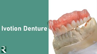 Ivotion Dentures  High Quality Monolithic Digital Dentures [upl. by Milstone]