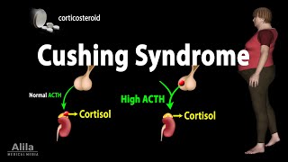 Cushing Syndrome Animation [upl. by Parlin]