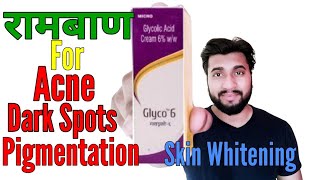 Acne Scars Pimple Marks Pigmentation Skin Whitening By Glyco 6 Cream Glycolic Acid Review [upl. by Decato901]