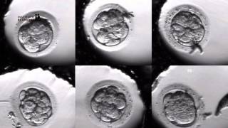 How In Vitro Fertilization IVF Works An Overview  Esco Medical [upl. by Eseyt]