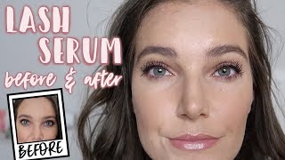 LASH SERUM BEFORE amp AFTER RESULTS  Worth the Cash  Sarah Brithinee [upl. by Wolfram356]