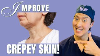 How To Improve Crepey Skin Holistically [upl. by Price]