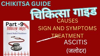 Part 9 ASCITIS ascites जलोदर Chikitsa guide चिकित्सा गाइड General medical practitioner treatment 💊💉 [upl. by Zerep]