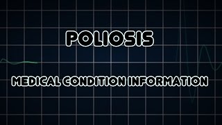 Poliosis Medical Condition [upl. by Aihsenet666]