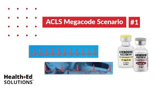 ACLS Megacode Scenario 1 Supraventricular Tachycardia SVT [upl. by Mareah704]