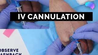 Intravenous IV cannulation  OSCE Guide  UKMLA  CPSA [upl. by Barnum]