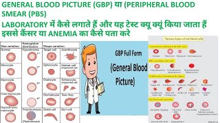 CBC SE GBP या PBS GENERAL BLOOD PICTURE or PERIPHERAL BLOOD SMEAR KI REPORT KAISE BANAYE [upl. by Fidelity]