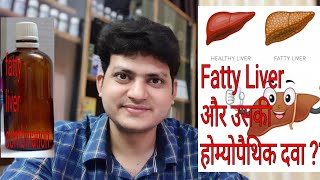 Fatty liver  Homeopathic Medicine for Fatty liver  My Combination [upl. by Crudden]