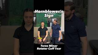 Hornblower’s Sign  Teres Minor Rotator Cuff Tear Diagnosis [upl. by Duax389]