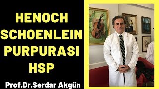 Henoch Schonlein Purpurası HSP Serdar Akgün [upl. by Jar]